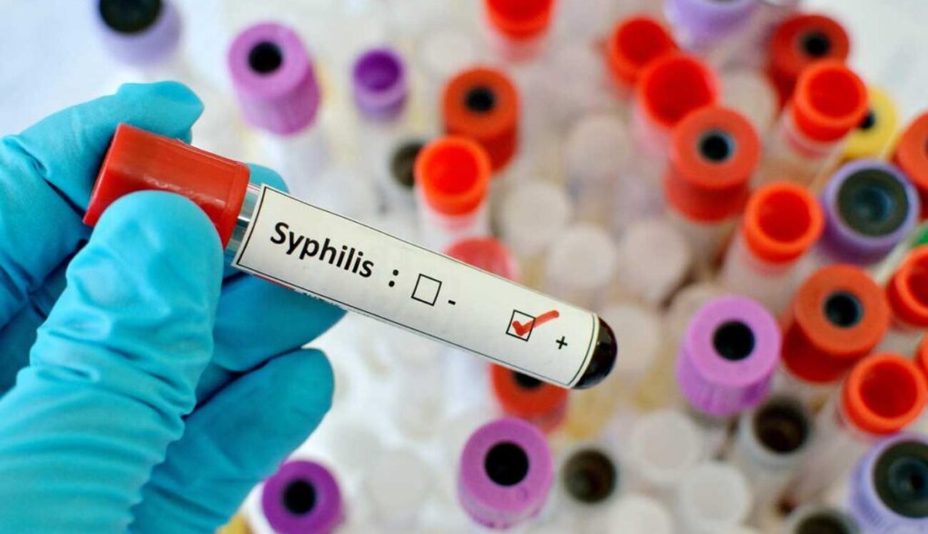 blood-sample-with-syphilis-treponema-pallidum-positive