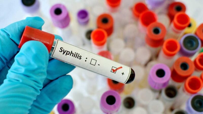 blood-sample-with-syphilis-treponema-pallidum-positive